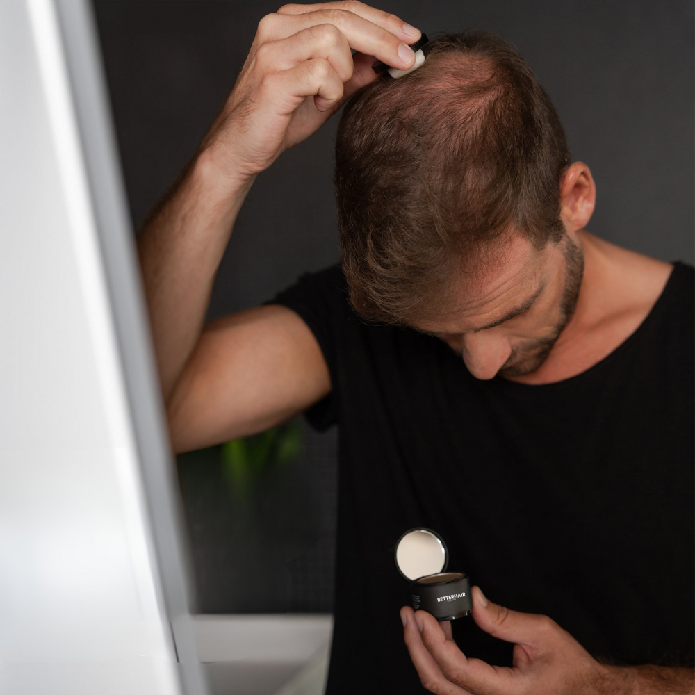 BHFM`s Hårpuder - Få tillbaka självförtroendet och håret utan behandlingar